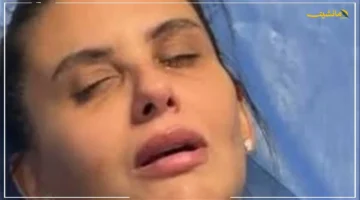 أول تعليق من دانا حمدان.. تكشف عن تشوه وجهها ومفاجأة ما حدث في جلسة التجميل